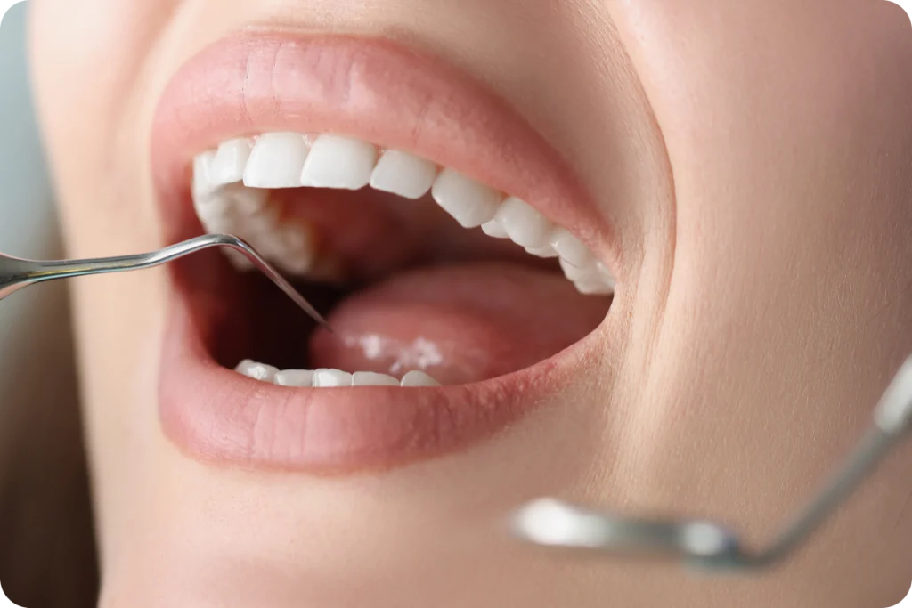 greffe gencive narbonne esthetique Dentiste à Narbonne, Cabinet dentaire La Tramontane