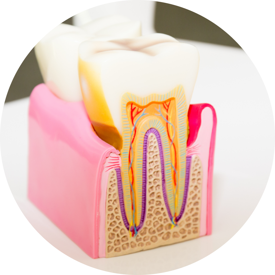 retraitement endodontique narbonne dentiste Dentiste à Narbonne, Cabinet dentaire La Tramontane