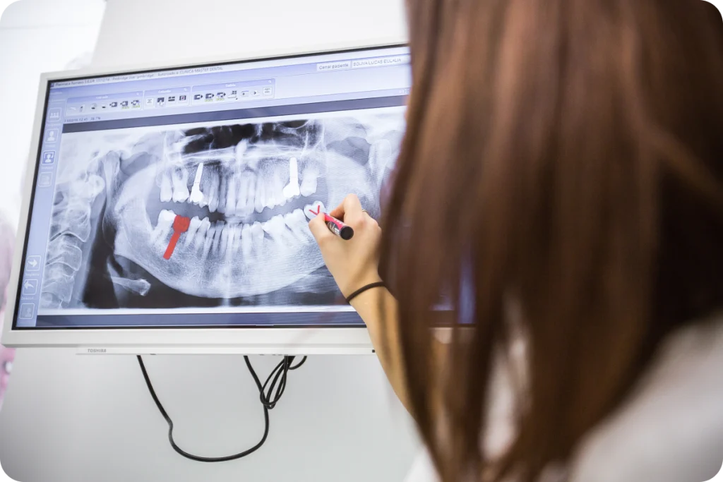 consultation implant dentaire ceramique narbonne Dentiste à Narbonne | Cabinet dentaire La Tramontane